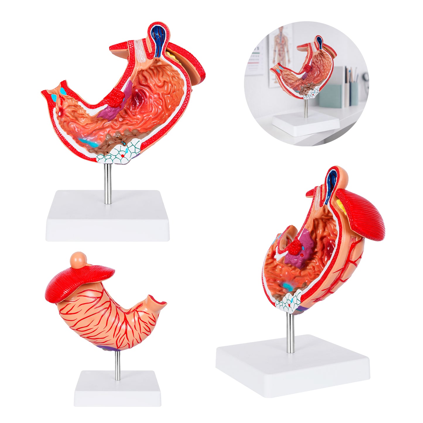 MODELO GASTRO CP 160